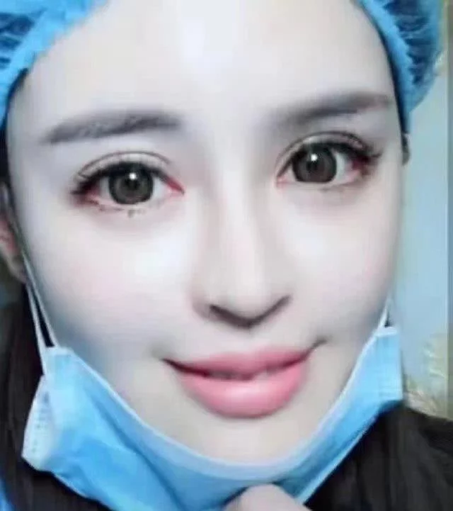 土豪女整容成功,恢复好摘掉口罩那一瞬间 网友:上帝整的 -第4张图片-爱站屋博客 土豪女整容成功,恢复好摘掉口罩那一瞬间 网友:上帝整的 -第4张图片-爱站屋博客