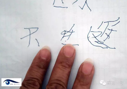 祖孙三人食自制臭豆腐中毒 奶奶怕花钱放弃治疗 祖孙三人食自制臭豆腐中毒 奶奶怕花钱放弃治疗