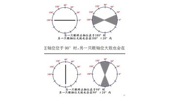 散光轴位