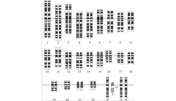 根据一般人类体细胞所拥有的染色体而绘制的"染色体组型图"