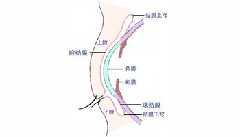 按其所在部位分为睑结膜,球结膜和结膜穹窿.