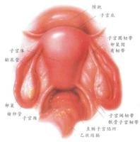 宫颈管粘连
