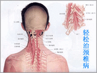 颈椎疾病