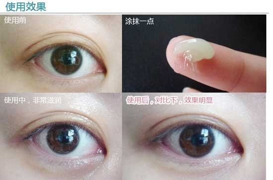 Sisleyϣ˼Àè˲¼ä½ôÖÂÑÛĤ10ml