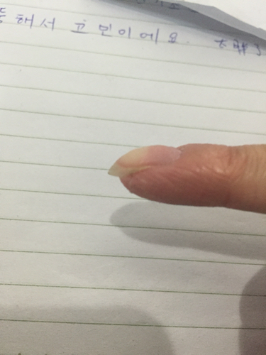 生完宝宝一年后!怎么指甲全部都凹凸不平!不会