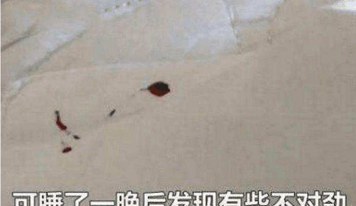 男子住酒店, 睡觉时被虫叮咬疼醒, 开灯一看全是