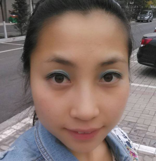 磨腮,还是打瘦脸针,那个管用?_360问答