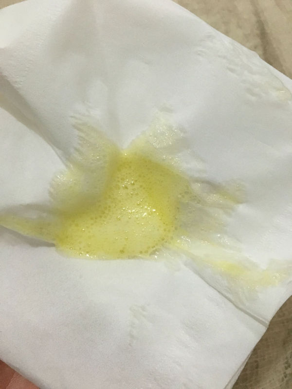 狗一岁前天给它吃的猪肝和猪蹄,昨天拉肚子没