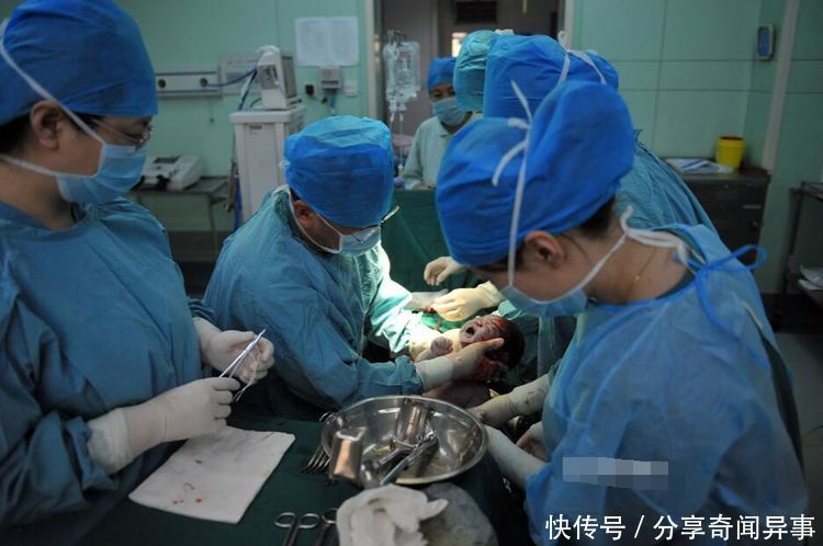 少女怀二胎,9个月时肚子疼送医院,剖开肚皮医