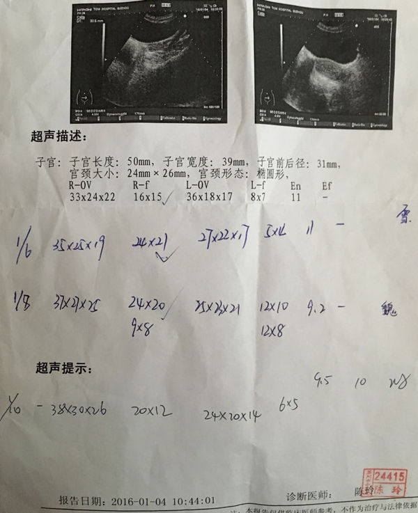 1月6号1月8号查卵泡大小21*24,椭圆形很厉害