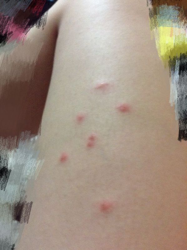 这是长的什么?不像是蚊子咬的、莫名其妙就长