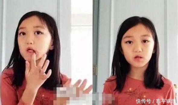 李亚鹏晒李嫣最新正面照,经过多次治疗,她的唇