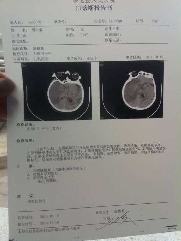 脑内ct现在这个情况严重吗