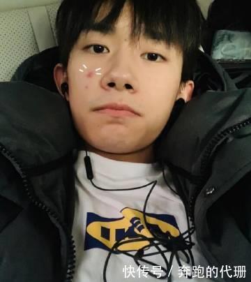 易烊千玺脸上长痘 在线撒娇:是不是太过分了 |网