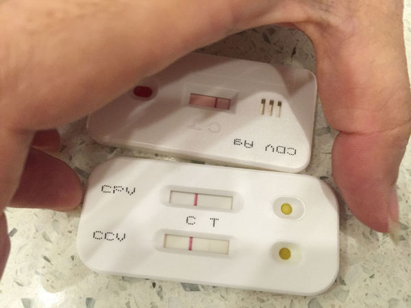 小狗有没有可能同时出现两种病毒?细小'冠状病