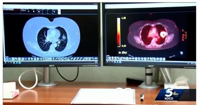 癌症晚期仅剩3个月 他却靠吃狗药痊愈!? 是真的