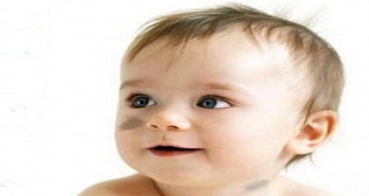 盘点宝宝常见的7种胎记,有5种容易长在脸上,父