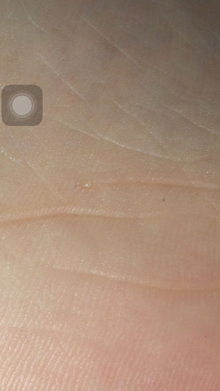 今天穿着鞋踩到了钉子,我脱了袜子,袜子是白色