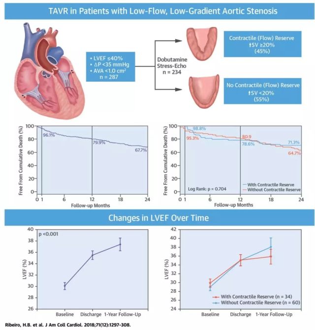 TAVR 治疗低射血分数、低跨瓣压差重度主动脉瓣狭窄患者