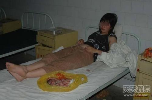 <em>女人裤裆</em>脏的毛+<em>女人裤裆</em>里都毛