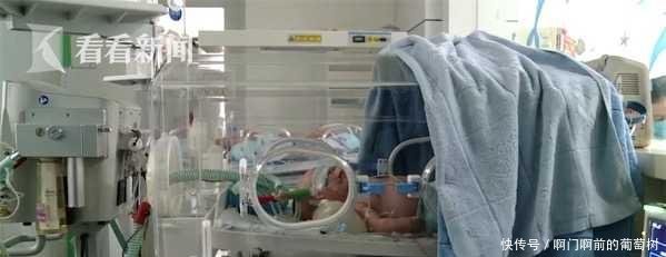 产妇自断脐带致婴儿染破伤风 出生4天畏声光抽