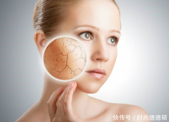 激素脸治疗用什么方法,激素脸应该怎么治