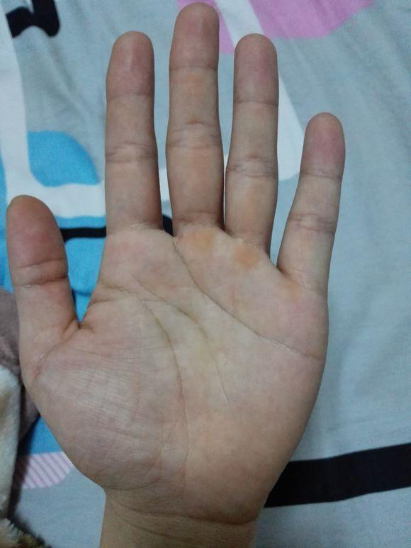 双手断掌纹的男人,事业辉煌,婚姻失意