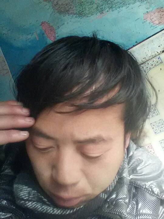 我前额两边头发少?该剪什么头型?男生_360问