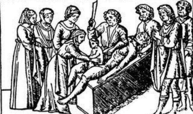 剖腹产属于难产吗