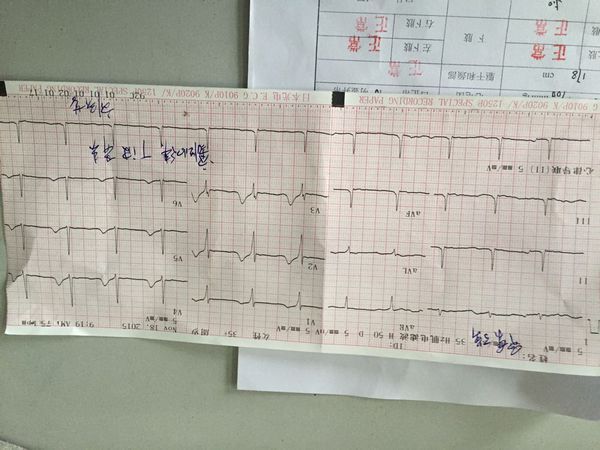 体检检查心电图T波异常,是怎么回事,血压160,1