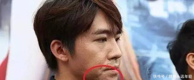 这10位明星脸上都有疤,郑爽被怀疑整容,杨幂自