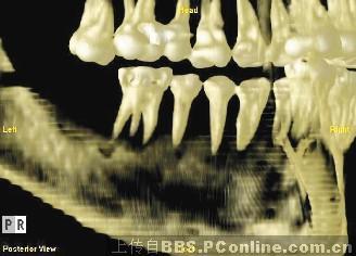 根据隆起的形状可以区别为丘状齿(bunodont),横堤齿(lophodont),半月