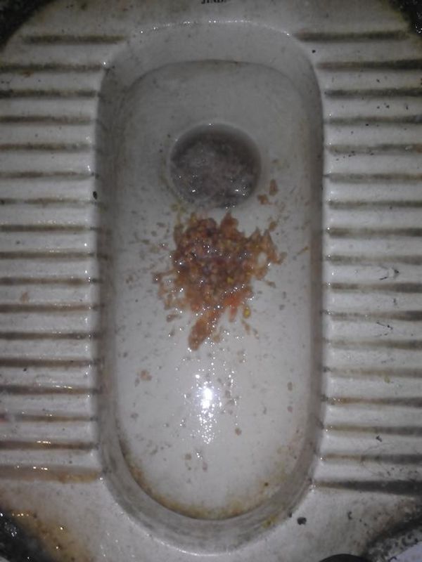 反酸烧心就吐了这不是第一次但是这次有点不一样。 晚上九点有点反酸烧心(感觉都不算烧了,感觉就像一滩_360问答