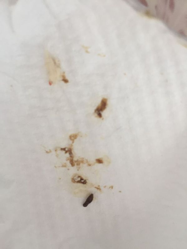 s拉肚子两天 不知道是因为啥 但还能正常吃食 