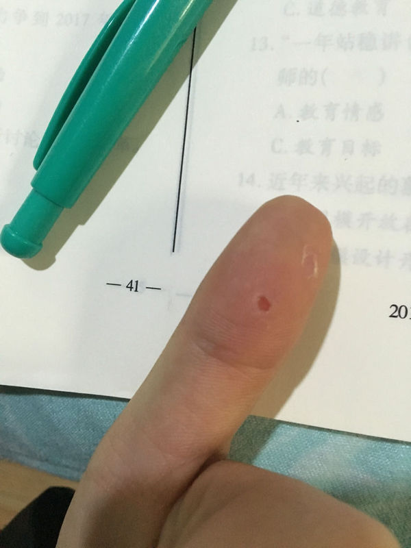 问:问:请问每到夏季,手指头上的皮肤里层就会出