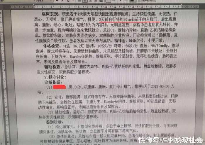 50岁男子将30公分茄子纳入体内, 网友: 加个土豆和青椒做个地三鲜