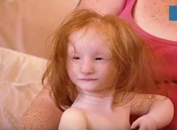 现实中的“拇指姑娘”,可以被父母“捧”在手心