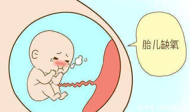 胎心监护出现这种情况,说明胎儿缺氧了!