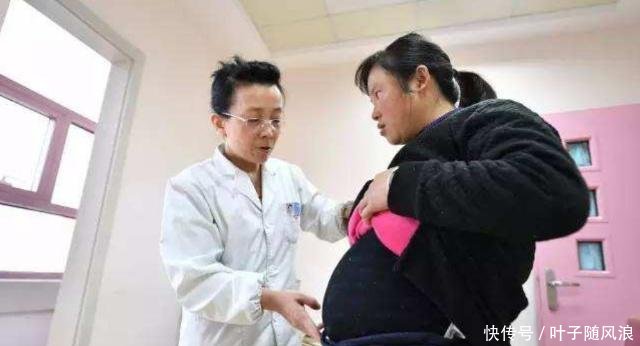 临近预产期,胎儿不入盆还能顺产吗?这种情况孕