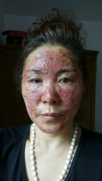 权健医学真的有这么神奇的产品吗