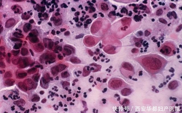 hpv是什么病毒是怎么来的 t01584936a09658cfd9.jpg?size=639x397