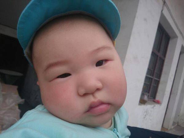 五个月发婴儿,下眼角红了好几天了,有时候抱着