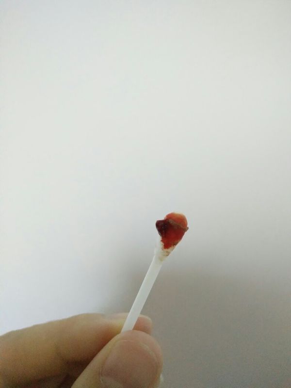牙龈出血不止,还在牙龈附近看到这个(看图,有点