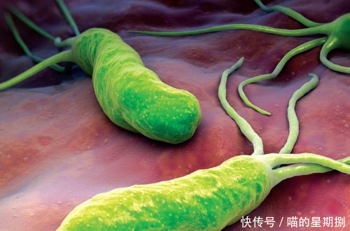 幽门螺旋杆菌的死敌是什么?这几种食物常吃,赶