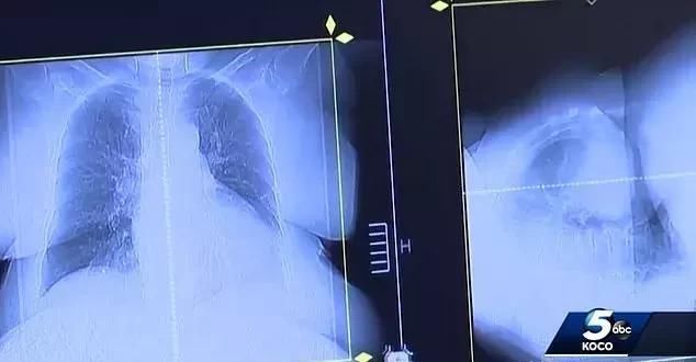 癌症晚期仅剩3个月 他却靠吃狗药痊愈!? 是真的