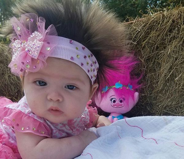 婴儿头发向上生长