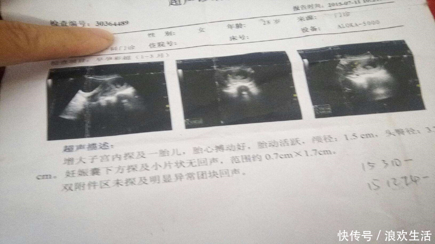 原来B超单上这2个数据,透露了胎儿这么多信息