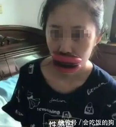 男子趁妻子睡着时,为她做“香肠嘴”,结果却令男子懊悔不已