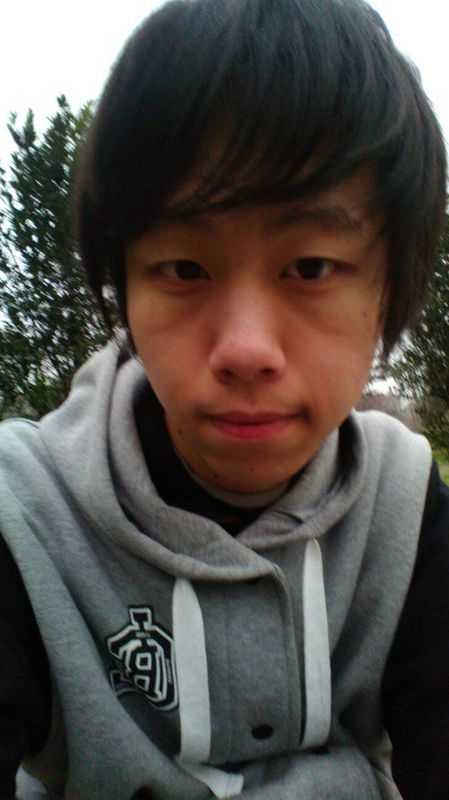 各位觉得我这眼袋深吗?眼袋下面有个斜的皱纹