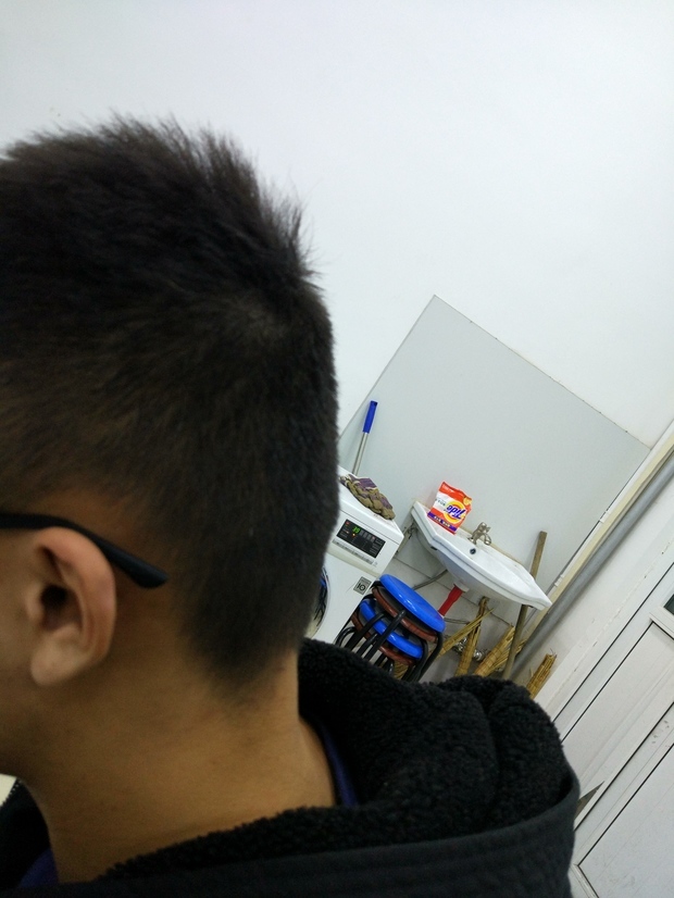 后脑勺扁平太严重了 侧面丑的一b 整得自己都